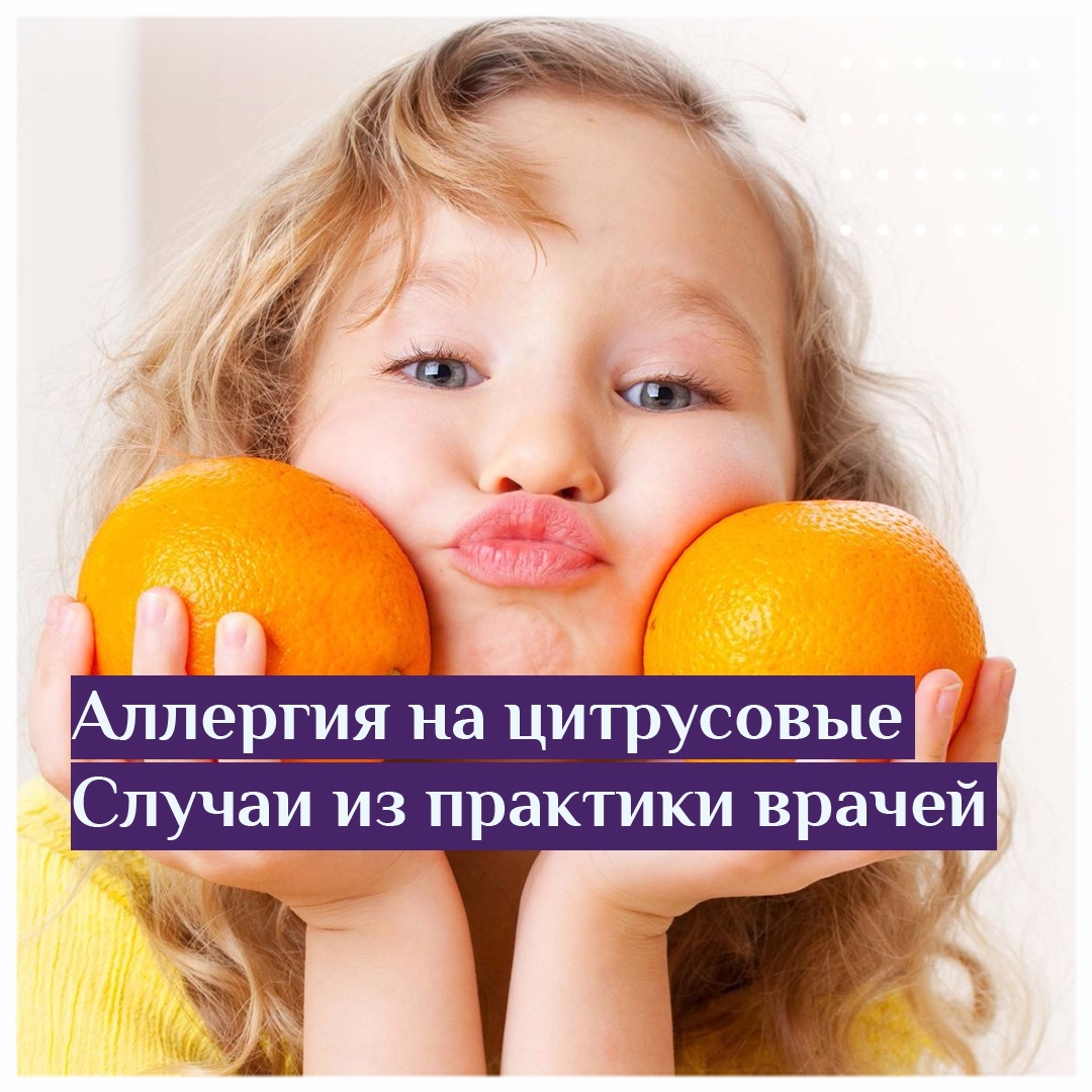 аллергия на цитрусовые случаи из практики врачей
